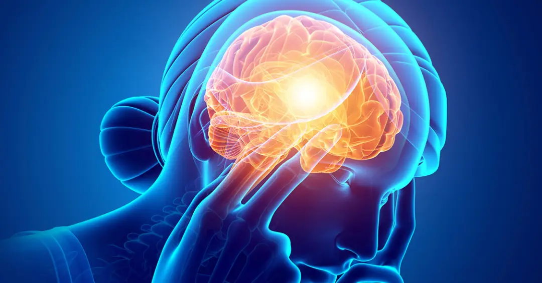 Pílula tripla reduz em 39% o risco de novos AVCs em estudo no Brasil