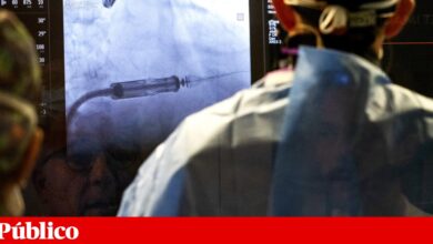 Uma em cada três mulheres morre de causa cardiovascular. Sintomas ainda são desvalorizados