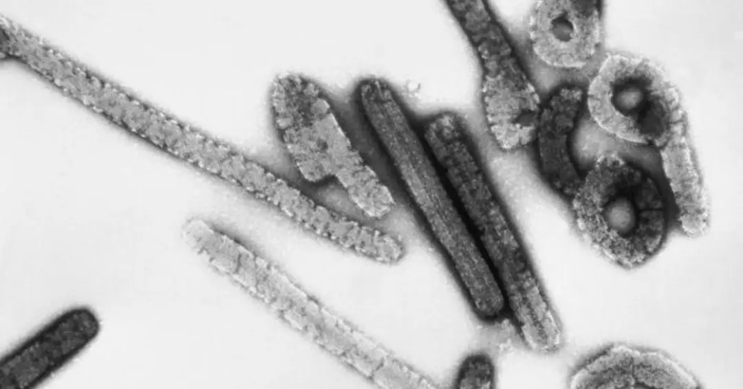 Etiópia registra primeiro surto de doença ‘prima’ do Ebola