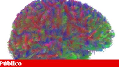 Há cinco fases do cérebro ao longo da vida, com alterações aos nove, 32, 66 e 83 anos