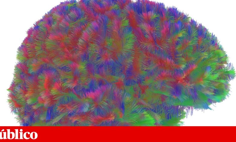 Há cinco fases do cérebro ao longo da vida, com alterações aos nove, 32, 66 e 83 anos