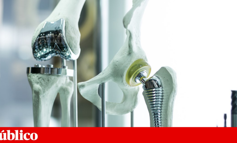 ISQ lidera projecto de implantes criados com IA e impressão 3D