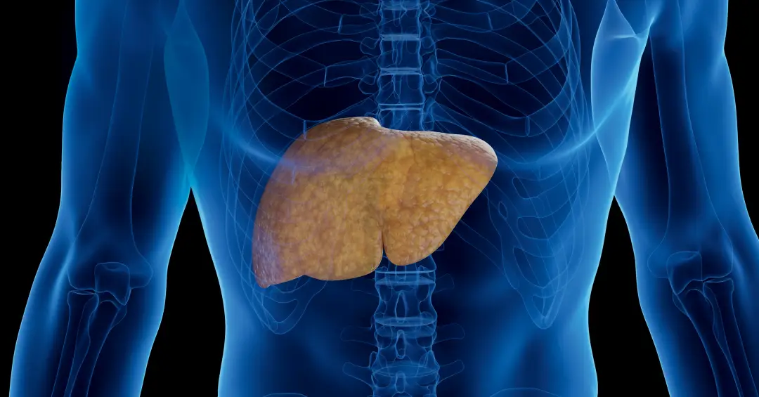 Nem o álcool nem os vírus por trás da hepatite: saiba qual é o maior inimigo do fígado