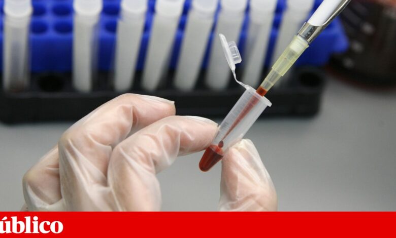Alemão está há mais de seis anos em remissão do VIH