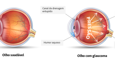 DIA MUNDIAL DO GLAUCOMA: Apenas dois especialistas para dez mil pacientes