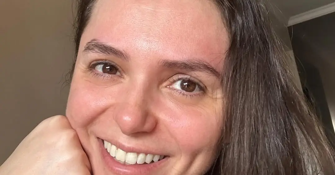 Especialistas explicam o que é crise de acatisia, vivida por Monica Iozzi