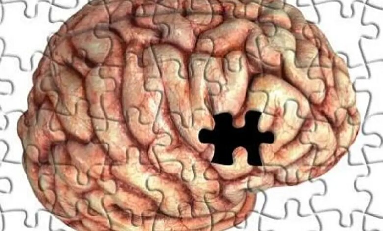 Alzheimer: entenda os estágios da doença que afeta ex-presidente FHC