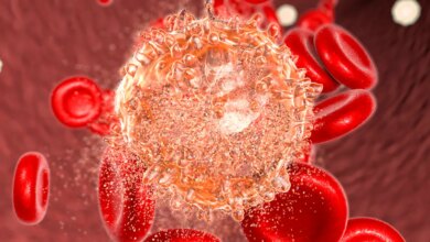 Leucemia mieloide aguda: estratégia muda paradigma do tratamento em idosos