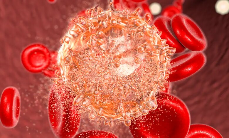 Leucemia mieloide aguda: estratégia muda paradigma do tratamento em idosos