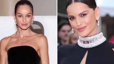 Cirurgião plástico alerta sobre alterações visuais de Izabel Goulart