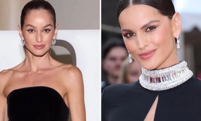Cirurgião plástico alerta sobre alterações visuais de Izabel Goulart