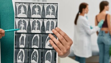 Anvisa aprova tratamento inédito contra doenças que formam cicatrizes nos pulmões