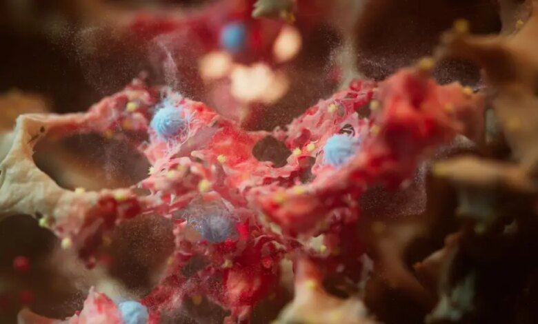 Câncer de pulmão: exame de sangue pode prever risco até 5 anos antes do diagnóstico