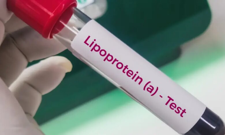 O exame de colesterol influenciado pela genética que você deveria fazer uma vez na vida