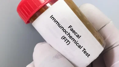 Novo teste com alta tecnologia para rastreamento do câncer de intestino chega ao SUS