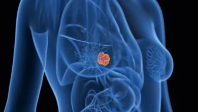Além da cirurgia: quando o câncer exige cuidado contínuo