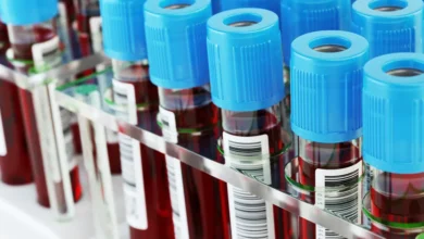Anvisa aprova novo exame de sangue para auxiliar no diagnóstico do Alzheimer