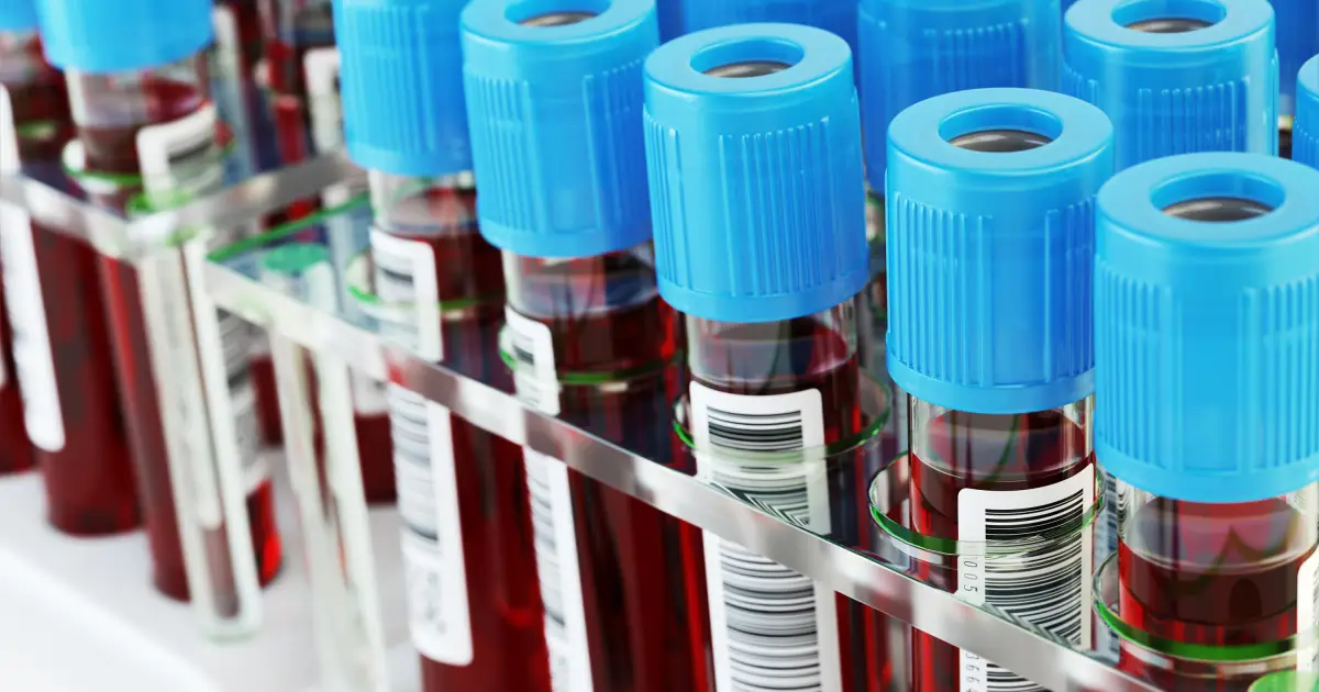 Anvisa aprova novo exame de sangue para auxiliar no diagnóstico do Alzheimer