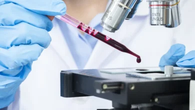 Teste de sangue que detecta sinal associado a mais de 50 tipos de câncer chega ao Brasil
