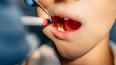 Crianças brasileiras vão ao dentista pela primeira vez só aos 7 anos, aponta levantamento