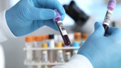 Exame de sangue para auxiliar no diagnóstico de Alzheimer chega ao Brasil